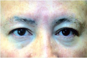 Micropigmentación masculina