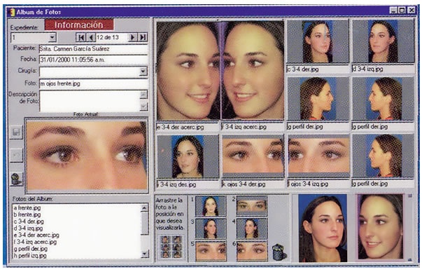 Registro fotográfico